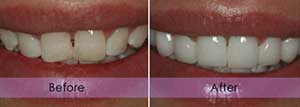 First EMAX At Sea Smile Dental Clinic, We provide the wide range of ...